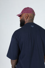 Oversized Nape Logo
